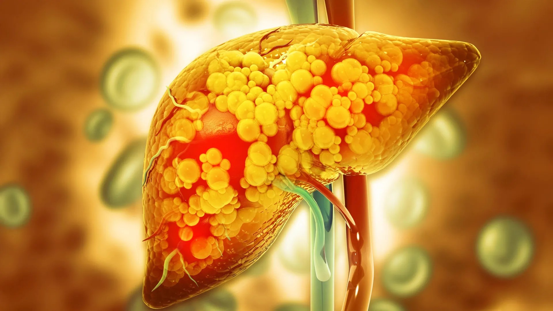 An enzyme that clears damaged liver cells