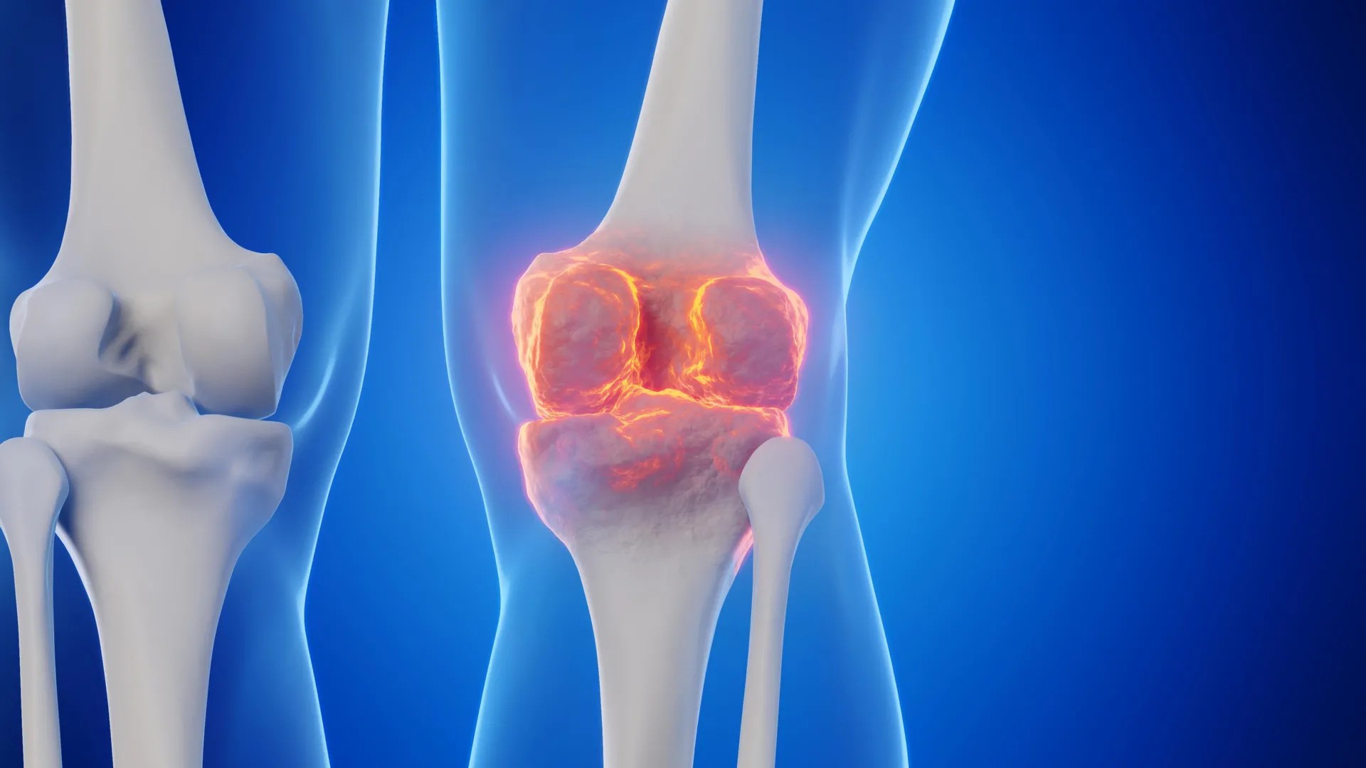 Blocking an aging protein regrows joint cartilage
