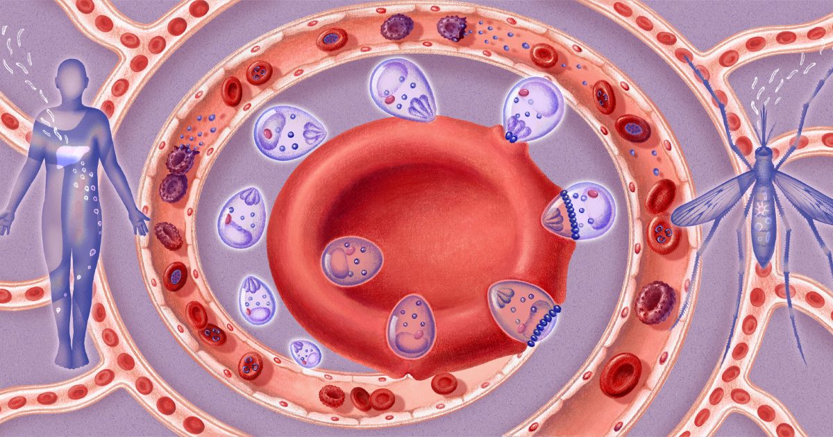 How malaria parasites slip into red blood cells