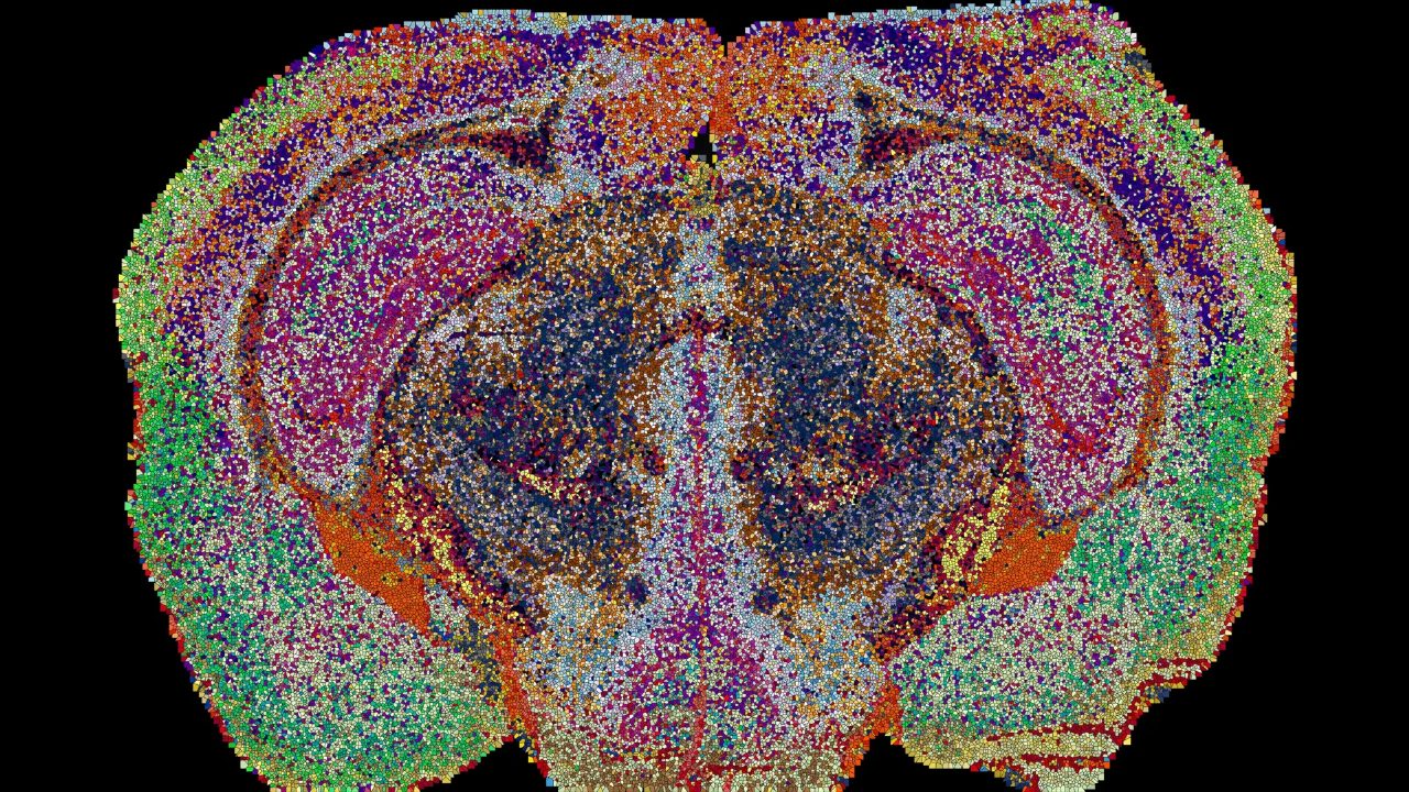 Mapping the brain through fatty molecules