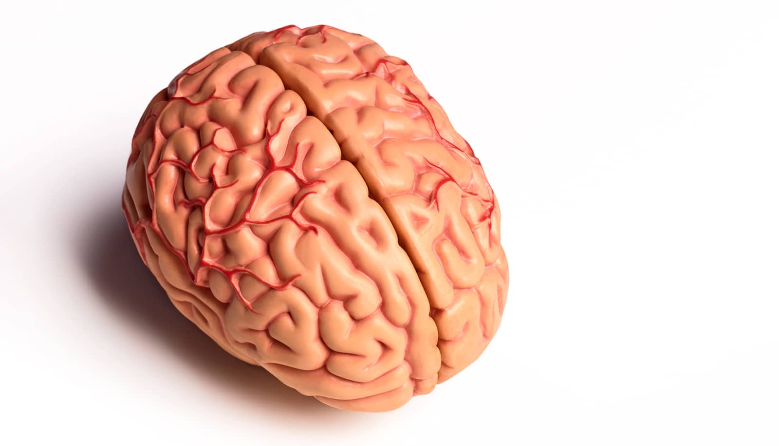 Rapamycin and brain blood flow in APOE4 carriers